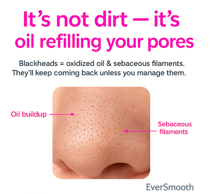 Limpiador de poros y puntos negros