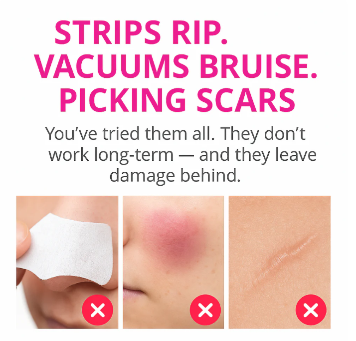 Limpiador de poros y puntos negros