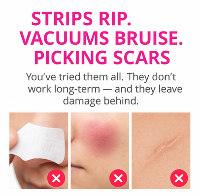 Limpiador de poros y puntos negros